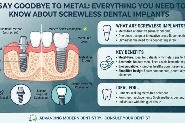 screwless dental implants